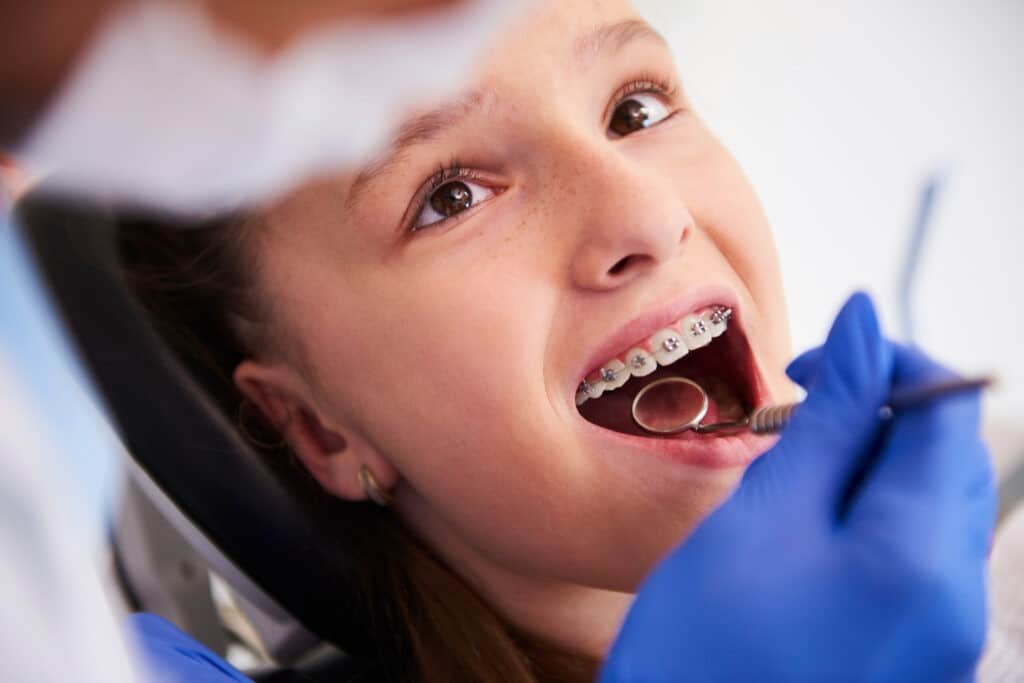How to Get Braces Covered by Medical Insurance